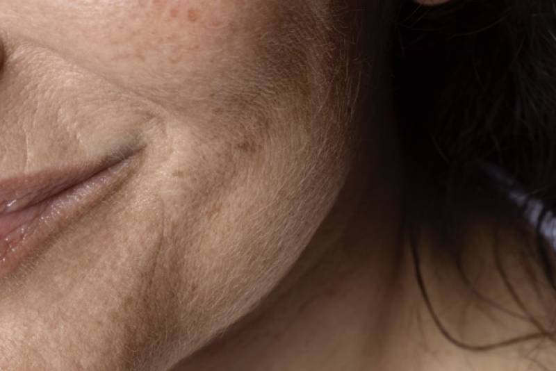 Soin visage anti-age régénérant - Radiofréquence Morpheus 8