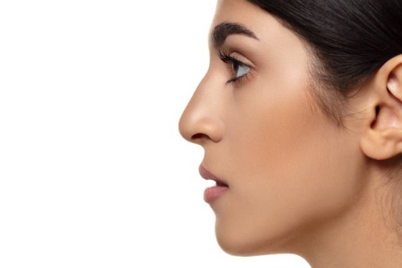 Traiter la bosse du nez sans chirurgie grâce à la rhinoplastie médicale à Aubagne