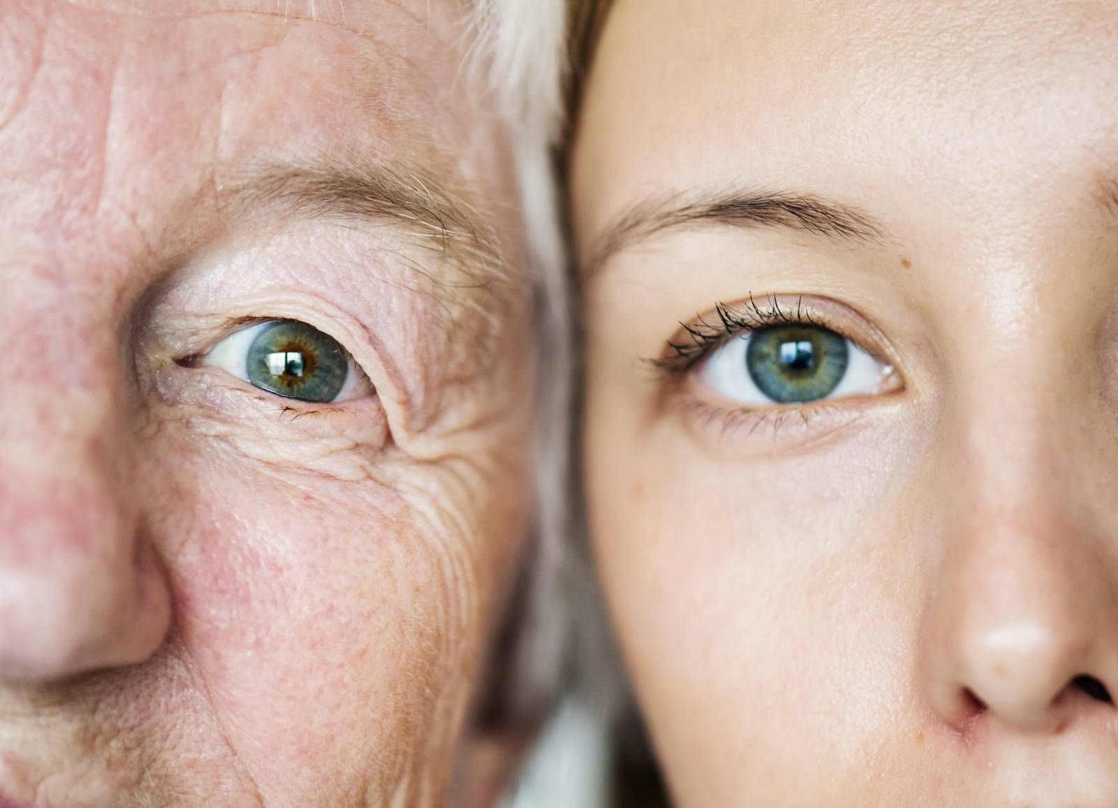 Blépharoplastie