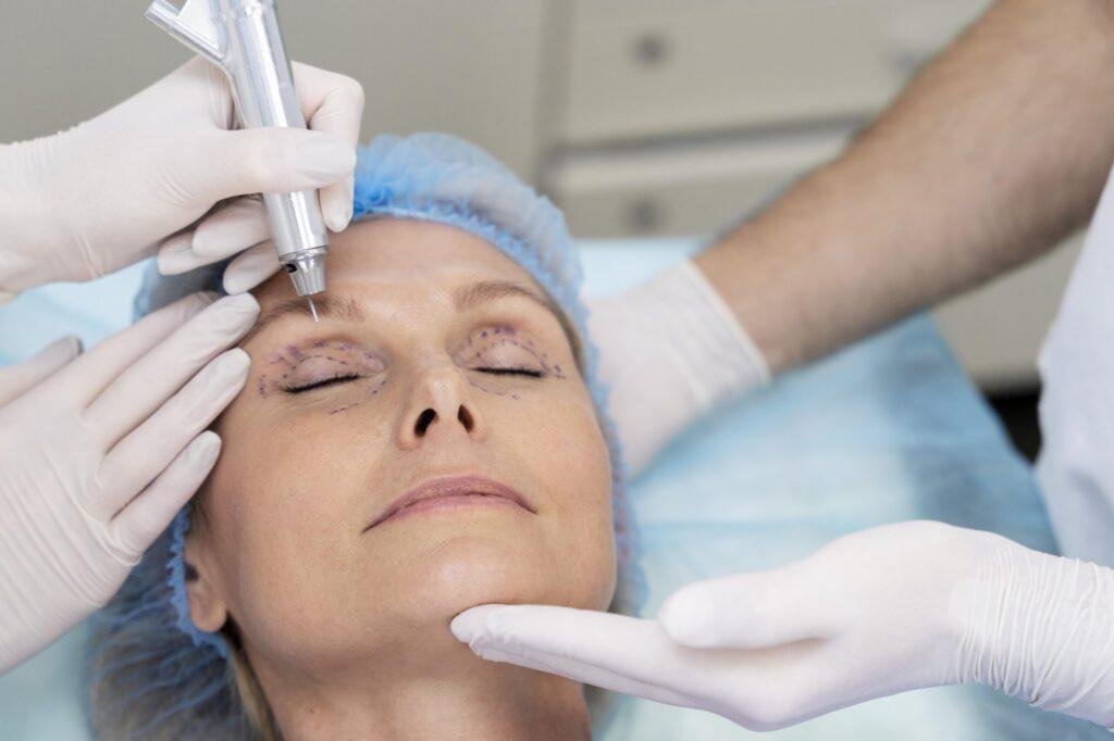 Praticien réalisant une blépharoplastie médicale au Plasma Pen sur les paupières d'une patiente à Aubagne.