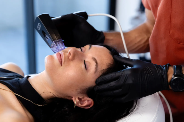 Séance de radiofréquence Morpheus8 sur le visage