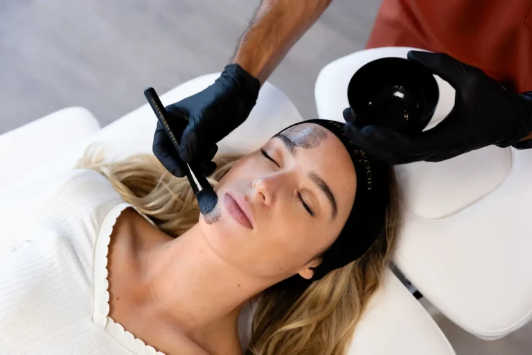 Application d’un peeling médical