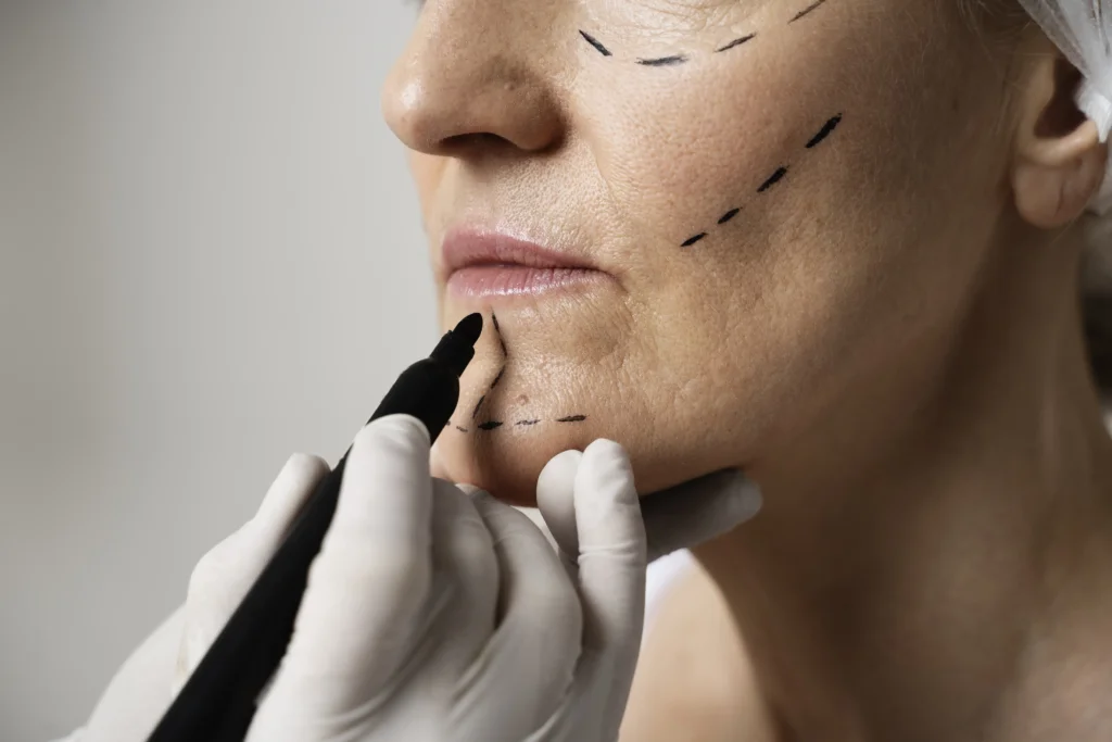 Visage tracé au crayon avant la pose de fils tenseurs