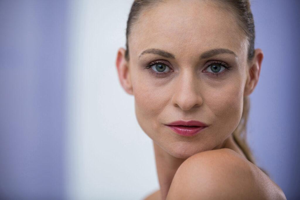 Portrait de face d'une femme présentant des cernes creusés et une perte de volume sous les yeux avant un traitement esthétique.