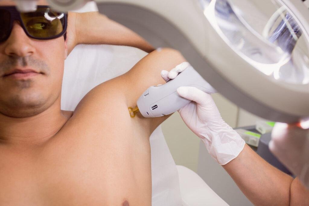 Épilation laser des jambes entières pour femme réalisée par une esthéticienne.