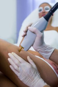 Praticienne utilisant une pièce à main laser haute précision sur la jambe d'une patiente au centre Gemelia à Aubagne.