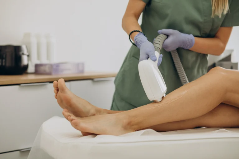 Retour épilation laser